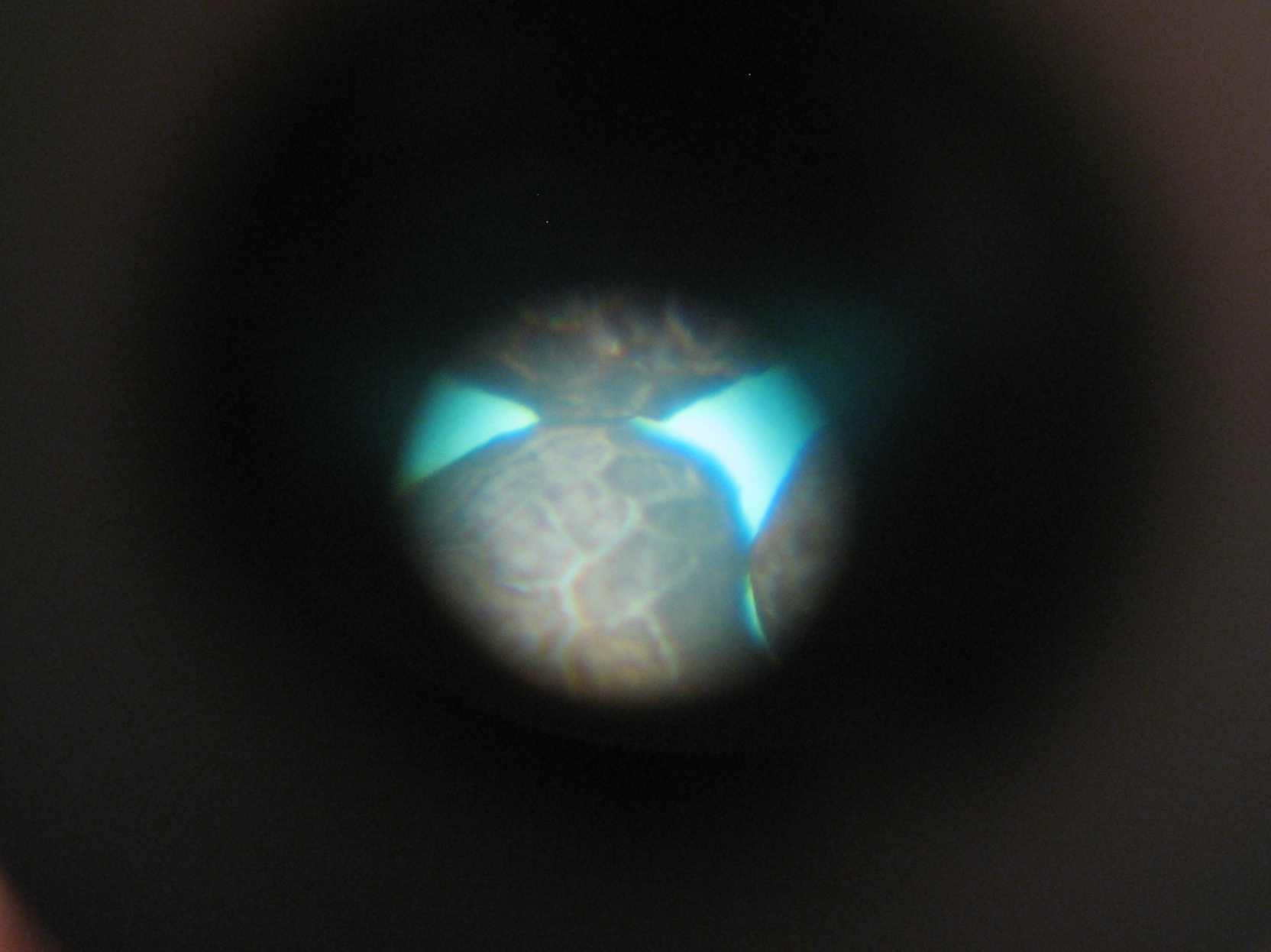 Poppy seeds through microscope