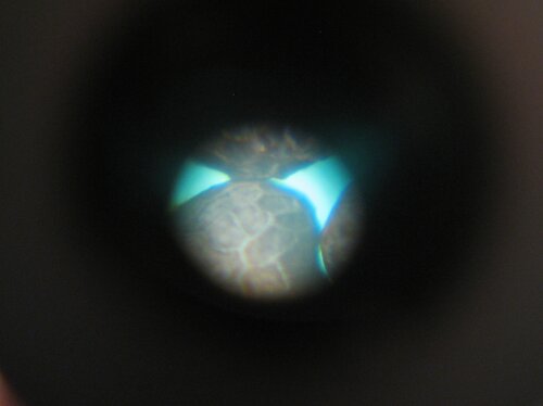 Poppy seeds through microscope